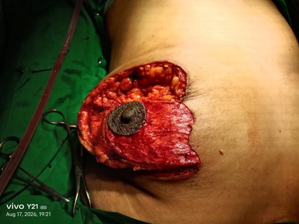 Breast Plastic Surgeon